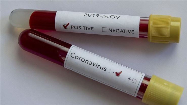 کرونا ویروس (CoV) جدید 2019 چیست؟